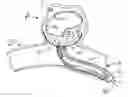 Fig. 01 - Aneurysm occlusion device