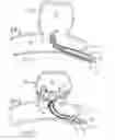 Fig. 02 - Aneurysm occlusion device