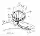 Fig. 06 - Aneurysm occlusion device