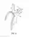Fig. 17 - Electrosurgical devices