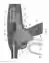 Fig. 09 - TWO STAGE TRIGGER, CLAMP AND CUT BIPOLAR VESSEL SEALER