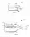 Fig. 02 - Surgical laser tool