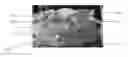 Fig. 01 - DENTAL DEVICE COMPRISING SURGICAL TEMPLATE AND FALSE TEETH SET AND RELATED METHODS