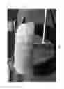 Fig. 07 - DENTAL DEVICE COMPRISING SURGICAL TEMPLATE AND FALSE TEETH SET AND RELATED METHODS