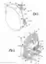 Fig. 02 - PRESS-FIT GLENOID WITH PERIPHERAL COMPRESSION PEGS