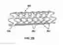 Fig. 04 - FULLY ABSORBABLE INTRALUMINAL DEVICES AND METHODS OF MANUFACTURING THE SAME