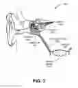 Fig. 03 - METHODS AND APPARATUSES FOR INCREASING MUCOCILIARY CLEARANCE