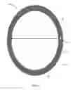 Fig. 02 - Multi-lumen catheter