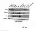 Fig. 02 - Method for treating prostate cancer