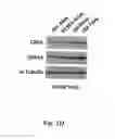 Fig. 04 - Method for treating prostate cancer