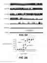 Fig. 09 - NOVEL NON-SELECTIVE CATION CHANNEL IN NEURONAL CELLS AND METHODS FOR TREATING BRAIN SWELLING