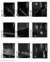 Fig. 30 - NOVEL NON-SELECTIVE CATION CHANNEL IN NEURONAL CELLS AND METHODS FOR TREATING BRAIN SWELLING