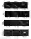 Fig. 33 - NOVEL NON-SELECTIVE CATION CHANNEL IN NEURONAL CELLS AND METHODS FOR TREATING BRAIN SWELLING