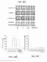 Fig. 35 - NOVEL NON-SELECTIVE CATION CHANNEL IN NEURONAL CELLS AND METHODS FOR TREATING BRAIN SWELLING