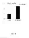Fig. 45 - NOVEL NON-SELECTIVE CATION CHANNEL IN NEURONAL CELLS AND METHODS FOR TREATING BRAIN SWELLING