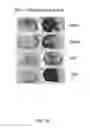 Fig. 53 - NOVEL NON-SELECTIVE CATION CHANNEL IN NEURONAL CELLS AND METHODS FOR TREATING BRAIN SWELLING