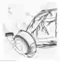 Fig. 01 - Ventricular cuff