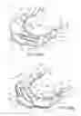 Fig. 35 - Ventricular cuff