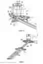 Fig. 02 - Neurosurgical device and method