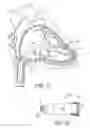 Fig. 02 - Interventional medical systems, tools, and subassemblies