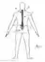 Fig. 02 - System and method for stabilizing implanted spinal cord stimulators