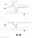 Fig. 15 - Method and system to start and use combination filler wire feed and high intensity energy source for welding