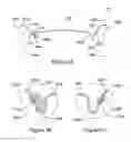 Fig. 07 - LIGHTWEIGHT, HINGED SELF-CLOSING CONTAINER COVERS AND ELASTOMER SPRINGS FOR USE WITH SUCH COVERS