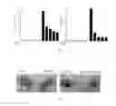 Fig. 02 - Anti-inflammatory lipopeptide and preparing method and application thereof
