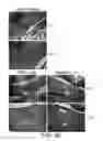 Fig. 05 - Method for treating spinal cord injury using HMGB1 fragment