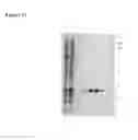 Fig. 50 - Repeat protein from collection of repeat proteins comprising repeat modules