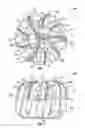 Fig. 02 - Specialized bit for challenging drilling environments