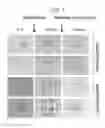 Fig. 02 - A RAPID QUANTITATIVE ASSAY TO MEASURE CFTR FUNCTION IN A PRIMARY INTESTINAL CULTURE MODEL