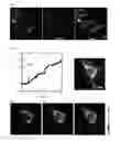 Fig. 03 - REAGENT FOR IMAGING INTRACELLULAR ACETYLATION