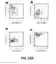 Fig. 43 - Methods and Devices for Detecting Diabetic Nephropathy and Associated Disorders