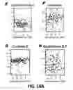 Fig. 45 - Methods and Devices for Detecting Diabetic Nephropathy and Associated Disorders