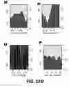 Fig. 55 - Methods and Devices for Detecting Diabetic Nephropathy and Associated Disorders
