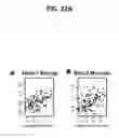 Fig. 99 - Methods and Devices for Detecting Diabetic Nephropathy and Associated Disorders