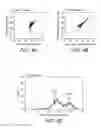 Fig. 05 - Method, composition, isolation and identification of a plaque particle and related biomarker