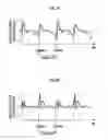Fig. 07 - Upper body motion measurement system and upper body motion measurement method