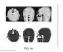 Fig. 02 - Systems and methods for magnetic resonance bone depiction