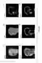 Fig. 06 - Systems and methods for magnetic resonance bone depiction