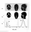 Fig. 07 - Systems and methods for magnetic resonance bone depiction