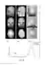 Fig. 09 - Systems and methods for magnetic resonance bone depiction