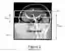 Fig. 03 - Pseudo-continuous asymmetric signal targeting alternating radio frequency (pASTAR) for magnetic resonance angiography
