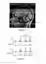 Fig. 06 - Pseudo-continuous asymmetric signal targeting alternating radio frequency (pASTAR) for magnetic resonance angiography