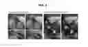 Fig. 08 - MRI methods and apparatus for flexible visualization of any subset of an enlarged temporal window