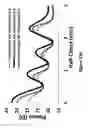 Fig. 131 - Lenses, devices, methods and systems for refractive error