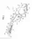 Fig. 02 - Vehicular grip structure