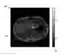 Fig. 01 - Dielectric encoding of medical images