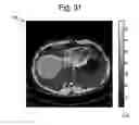 Fig. 29 - Dielectric encoding of medical images